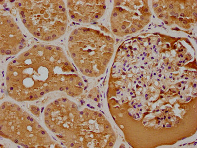 IFT74 Antibody