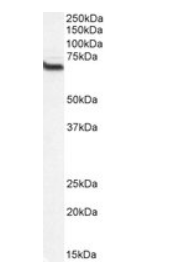 Goat anti-CMG1 / CCDC2 / IFT74, Biotinylated Antibody