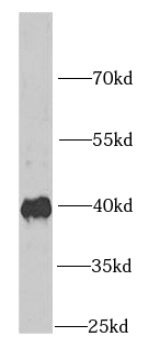 IGBP1 antibody