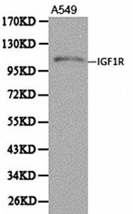 IGF-I Receptor beta antibody