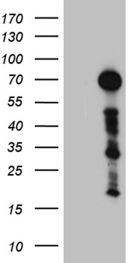 IGF1 Receptor (IGF1R) antibody