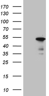 IGF1 Receptor (IGF1R) antibody
