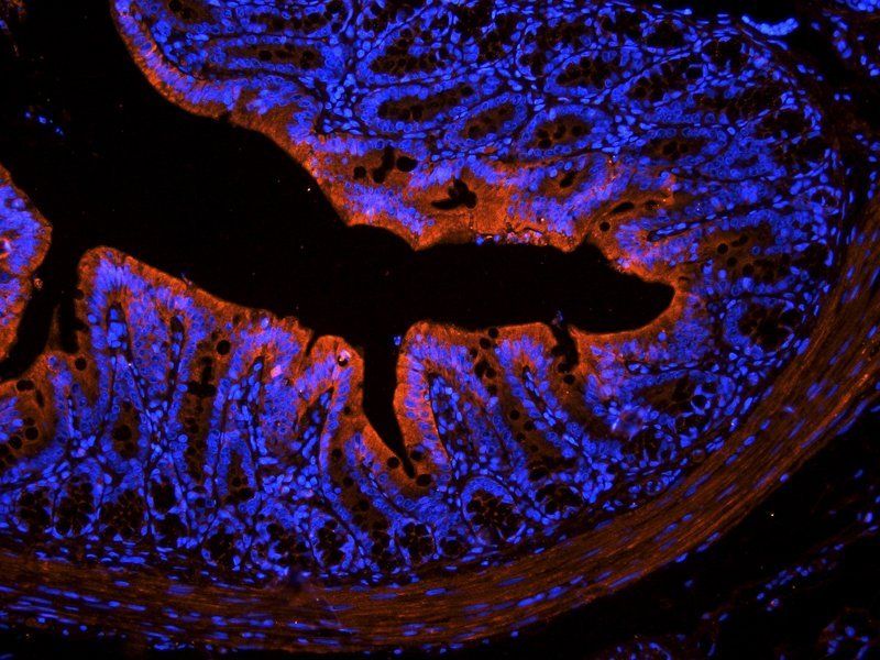 IGF1 antibody