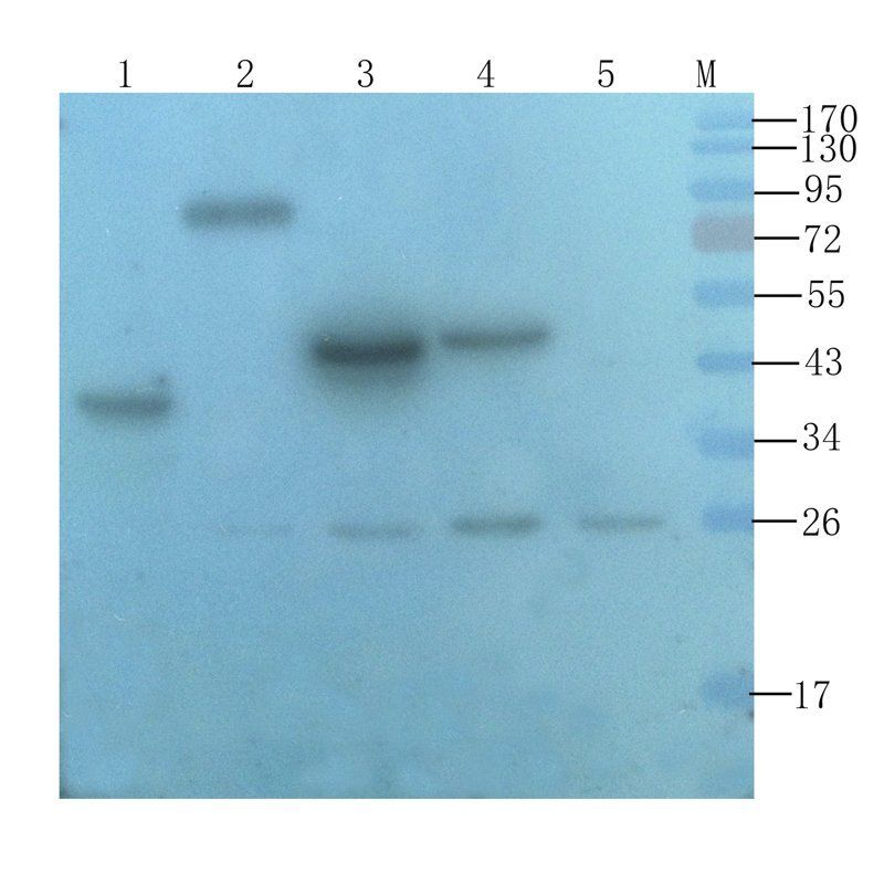 IGF1 Rabbit Polyclonal Antibody