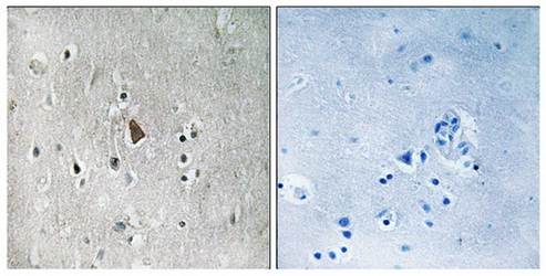 IGF1R (phospho-Tyr1346) antibody