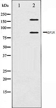 IGF1R antibody