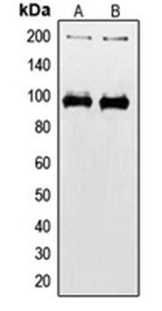 IGF1 R (phospho-Y1165/Y1166) antibody