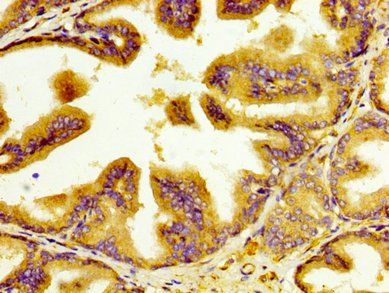 IGF2BP1 Antibody