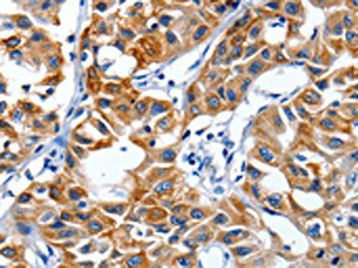 IGF2BP1 Antibody