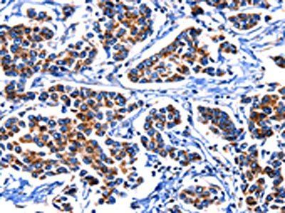 IGF2BP2 antibody