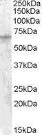 Goat anti-IGF2BP2 Antibody