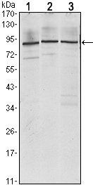 IGF2BP3 Antibody