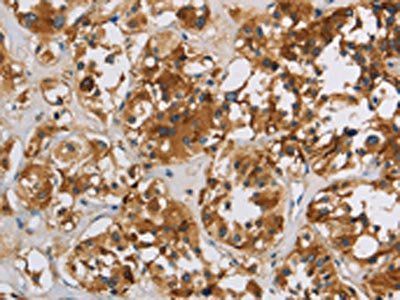 IGF2R Antibody