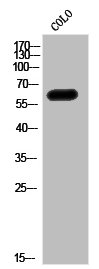 IGFALS antibody