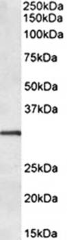 IGFBP1 antibody