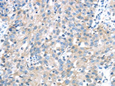 IGFBP3 Antibody