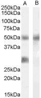 Goat anti-IGFBP3 Antibody
