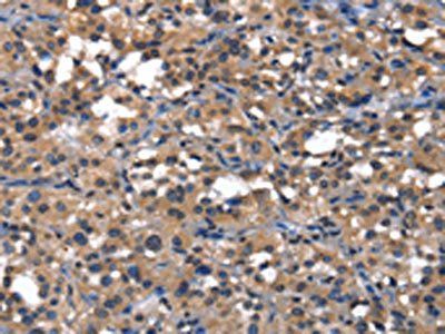 IGFBP5 Antibody
