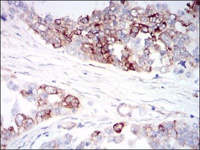 IGFBP7 Antibody