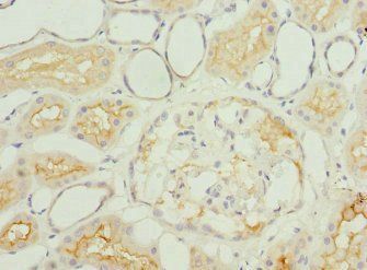 IGFL3 Antibody