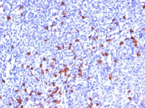 IgG (Immunoglobulin Gamma Heavy Chain) (B Cell Marker) Antibody