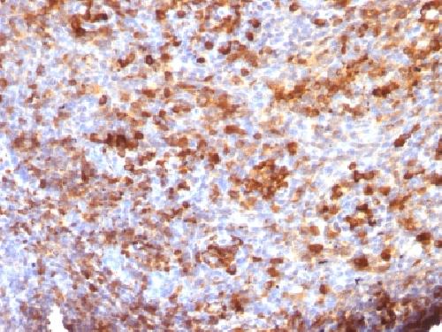 IgG (Immunoglobulin Gamma Heavy Chain) (B-Cell Marker) Antibody
