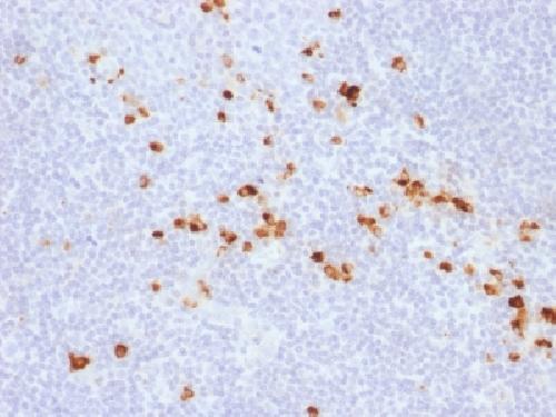 Recombinant IgG (Immunoglobulin Gamma Heavy Chain) (IGHG) (B-Cell Marker) Antibody