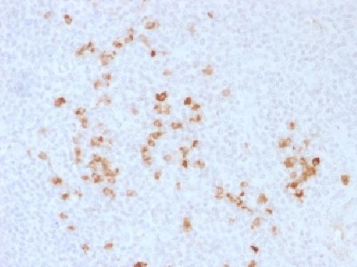 IgG (Immunoglobulin Gamma Heavy Chain) (B-Cell Marker) Antibody