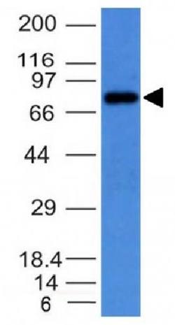 IgM (Immunoglobulin Mu Heavy Chain) (B-Cell Marker) Antibody