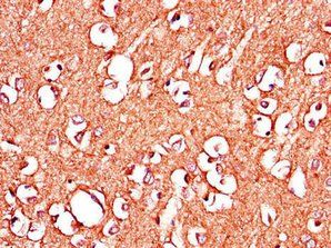 IGHMBP2 Antibody