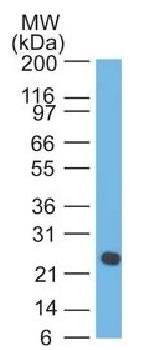 IGLV1-51 Antibody