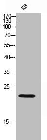 IGLL1 antibody