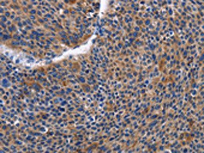 IGSF10 antibody