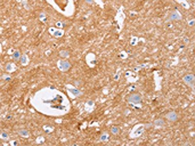 IGSF8 Antibody