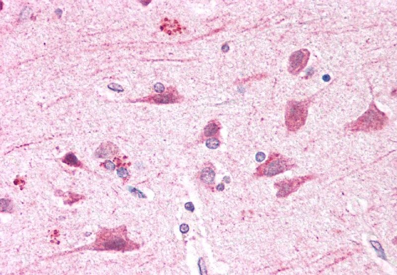Goat anti-BOD1L (aa2802-2815) Antibody