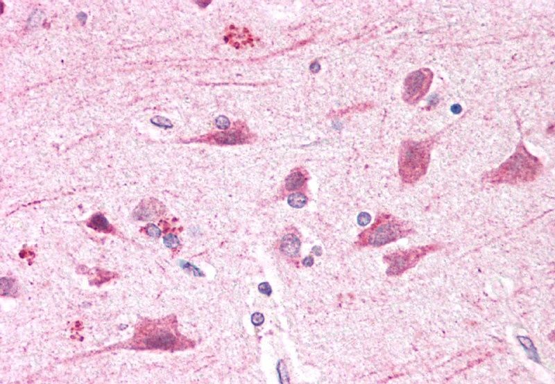 BOD1L antibody