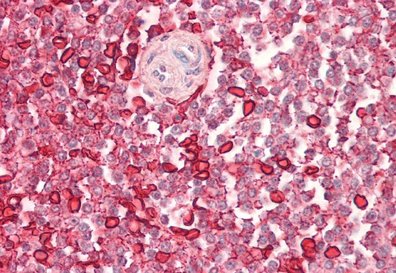 Goat anti-Wiskott-Aldrich Syndrome / WASP Antibody