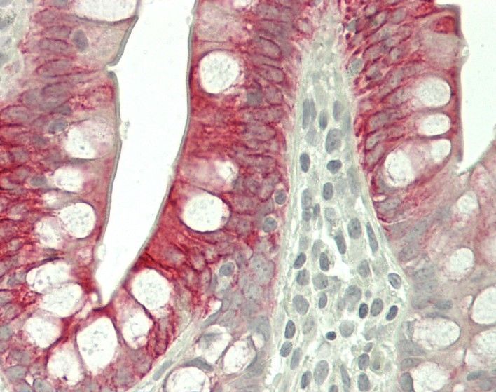 Mouse anti Cytokeratin 20