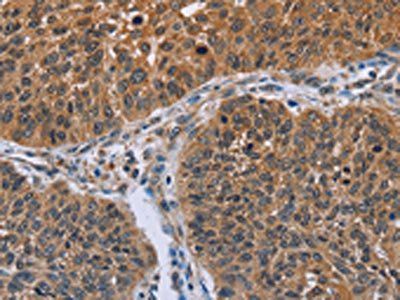 IHH Antibody