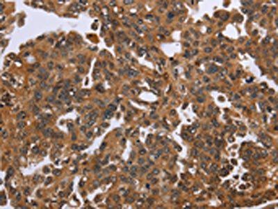 IHH Antibody