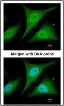 IKB alpha antibody