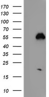 IKB zeta (NFKBIZ) antibody