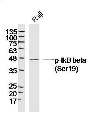 IkB beta (Phospho-Ser19) antibody