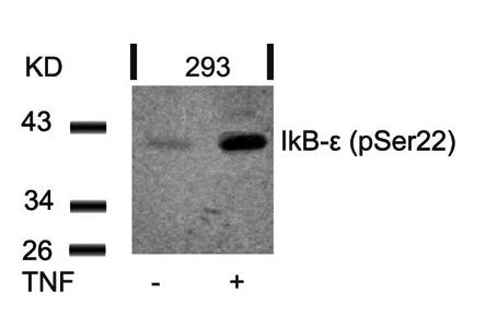 IkB-ε (Phospho-Ser22) Antibody