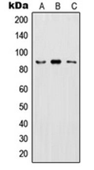 IKK beta (phospho-Y199) antibody