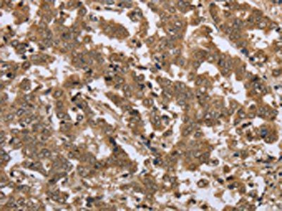 IKBKE Antibody