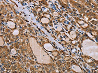 IKBKE Antibody