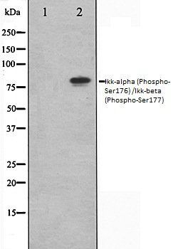 Ikk-alpha (Phospho-Ser176) /Ikk-beta (Phospho-Ser177) antibody