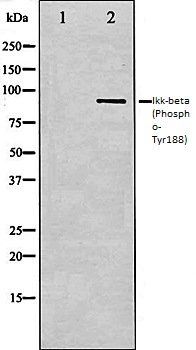 Ikk-beta (Phospho-Tyr188) antibody