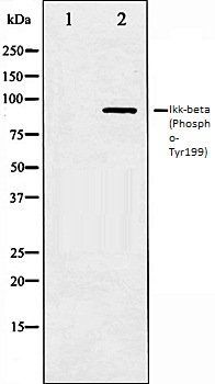Ikk-beta (Phospho-Tyr199) antibody